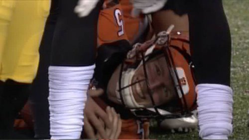 ryan_finley_teeth.jpg